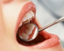 Ikdiena zobārstniecības kabinetos: pastāv liels risks inficēties ar C hepatītu